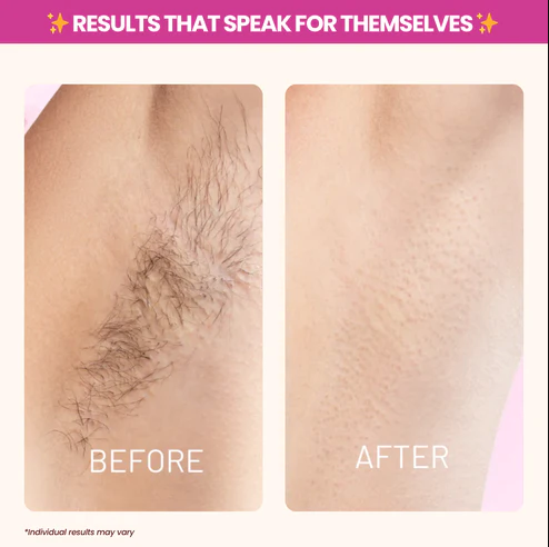 Soothing Silky Skin Treatment™