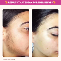 Soothing Silky Skin Treatment™