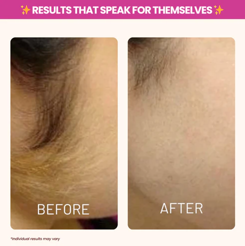 Soothing Silky Skin Treatment™