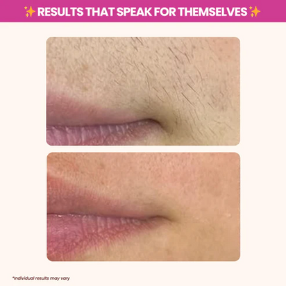 Soothing Silky Skin Treatment™